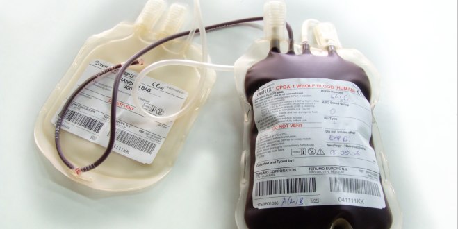 Blutkonserven als Therapiemöglichkeit einer Anämie