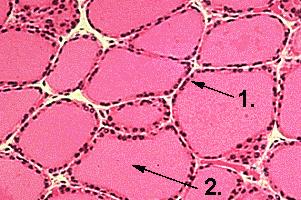 Schilddrüsenfollikel Schilddrüse Histologie