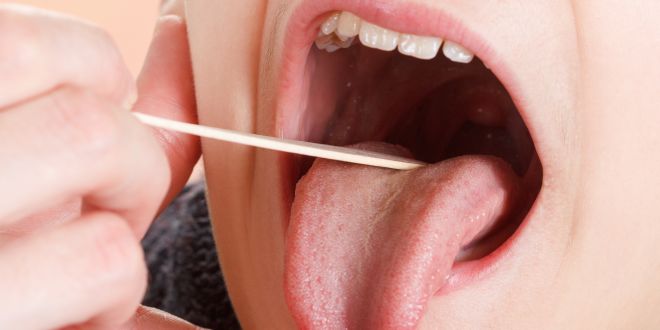 Mundhöhlenkrebs bilder Krebs Zunge