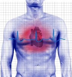 Herzinfarkt