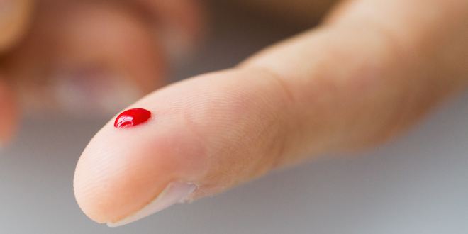 Für den HIV Schnelltest reichen einige Tropfen an Blut aus.