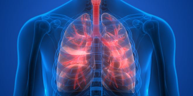 strukturelle Erkrankungen der Lunge