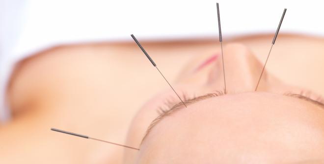 Schmerzen nach einer Akupunktur sind eine sehr selten auftretende Komplikation.