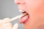 Test für rote Flecken auf der Zunge