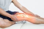 Test Beinschmerzen