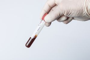 Test für Bakterien im Blut