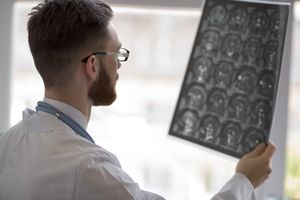 Radiologe befundet MRT vom Kopf