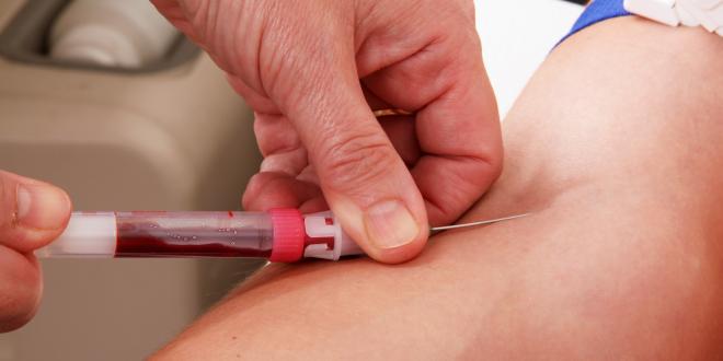 Hämatologie - Erkrankungen des Blutes- Blut abnehmen