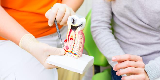 Erklärung einer Wurzelbehandlung anhand eines Zahnmodells