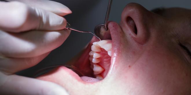Drogen durch schlechte zähne Schlechte Zähne: