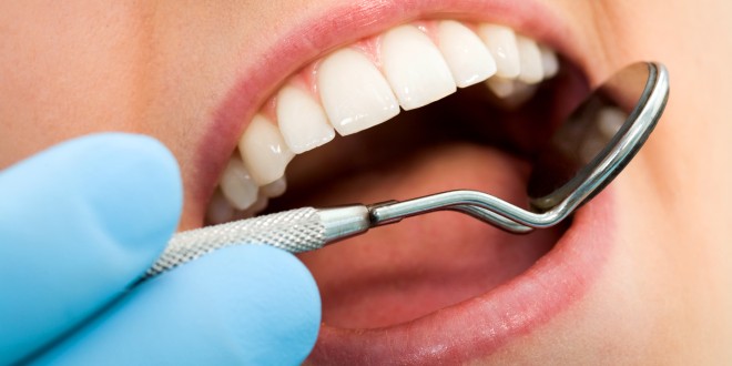 Zahnsteinradierer sollen im Kampf gegen Zahnstein unterstützend wirken.