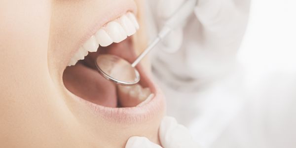 Untersuchung der Zähne beim Zahnarzt