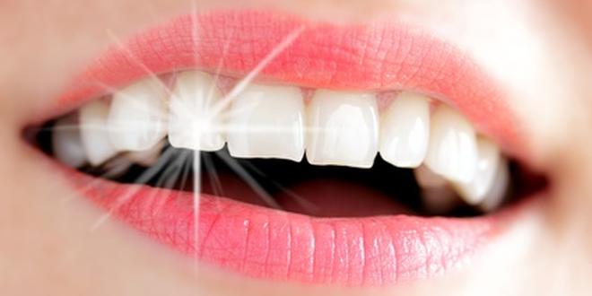 Weiße Zähne durch Bleaching- Wie funktioniert das?