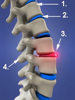 Abbildung Wirbelsäule und Bandscheibe