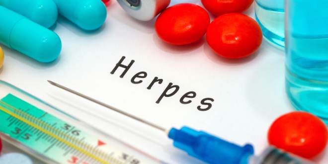 Arbeiten am auge mit herpes Könnte das