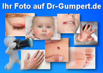 Schicken Sie uns Ihr Bild zu diesem Thema Bilderaufruf Dr-Gumpert.de