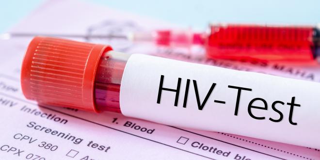Ausschlag aids Como Identificar