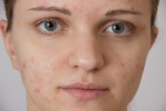 Pickel Bild klein