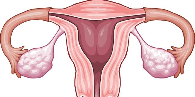 Wie krank entfernen eierstock lange Eierstockzysten (Ovarialzysten)