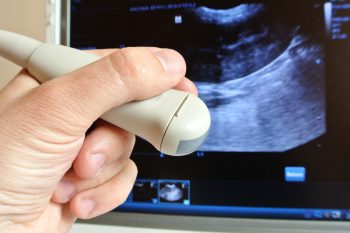 Ultraschalluntersuchung Ultraschalluntersuchung