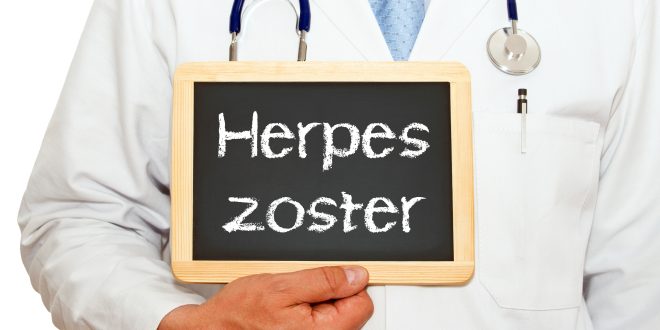 Herpes Zoster am Hals
