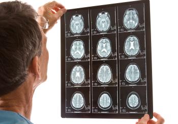 Hirntumor Diagnose