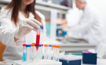 Diagnose bei eitriger Meningitis Frau hält Pipettierröhrchen in Labor