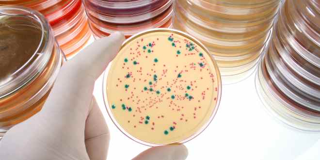Bakterienkulturen in Petrischale