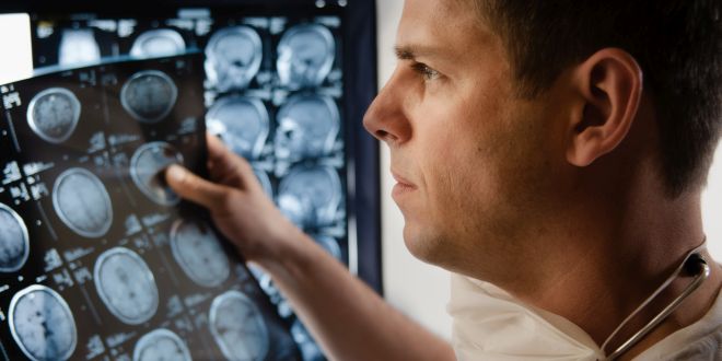 MRT beim Sturge-Weber-Syndrom Sturge-Weber-Syndrom MRT