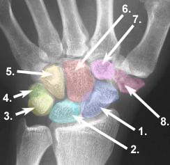 Röntgenbild des Handgelenks Handgelenk und Handwurzelknochen im Röntgenbild