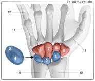 processus styloideus ulnae abriss processus styloideus ulnae abriss