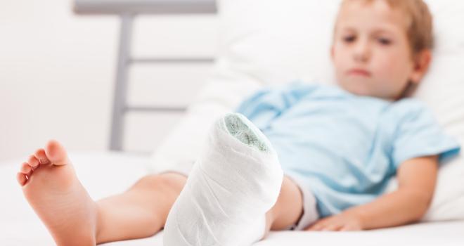 Gebrochen kein gips kind arm Rechter Arm