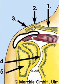 Abbildung Schulter