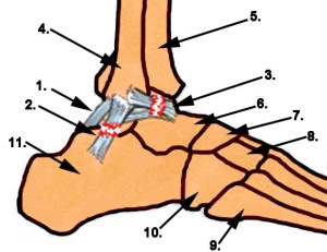 Abbildung Bänderriss Sprunggelenk