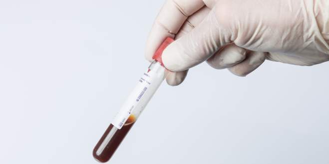 Chronisch myeloische Leukämie