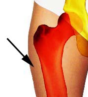 Schmerzen äußerer Oberschenkel