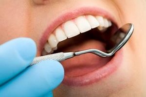 Leukoplakie