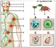 Lymphknoten geschwollen