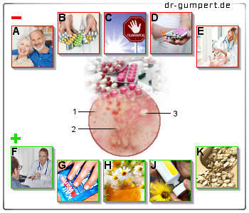 Abbildung Hautausschlag nach Antibiotikaeinnahme Abbildung Hautausschlag nach Antibiotikaeinnahme