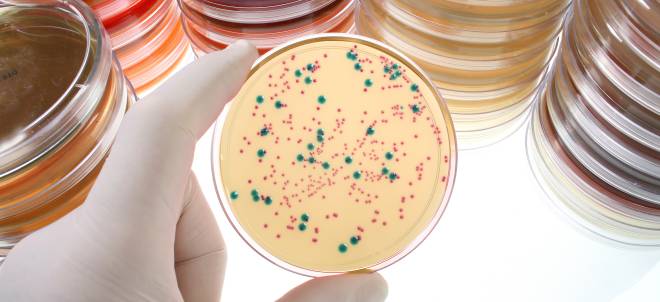 Escherichia coli Petrischale mit sichtbarem Bakterienwachstum