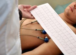 EKG