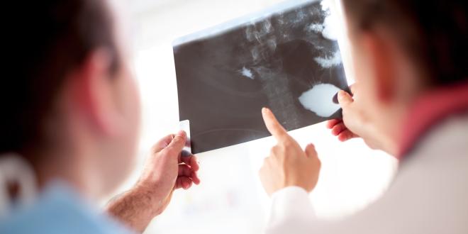 Periradikuläre Therapie