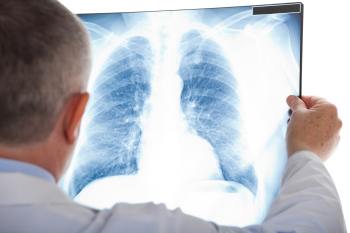 lungenentzuendung_bei_babys_diagnostik Diagnose der Lungenentzündung