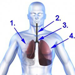 Pneumothorax