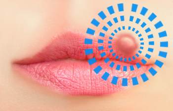 Medikamente gegen Herpesviren Medikamente Lippenherpes