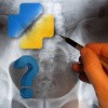 Quiz Orthopädie Quiz Orthopädie