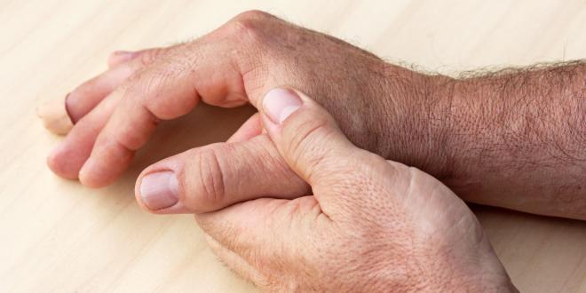 Rheuma Steife Finger durch Rheuma