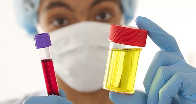 Blut im Urin Ursachen