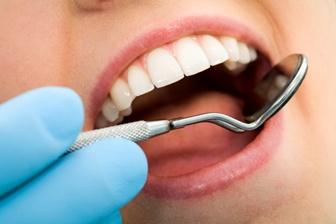 Leukoplakie