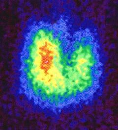 Schilddrüsenuntersuchung Schilddrüse Diagnostik